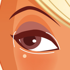 엘린의원 매직듀얼트임 수술 예시