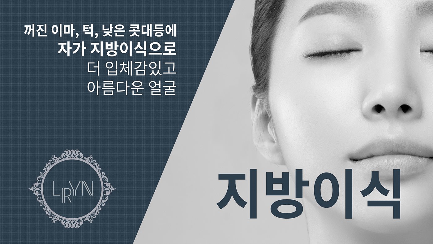 엘린의원, 지방이식 - 좁고 꺼진 이마, 턱, 낮은 콧대등 얼굴에 입체감과 윤곽을