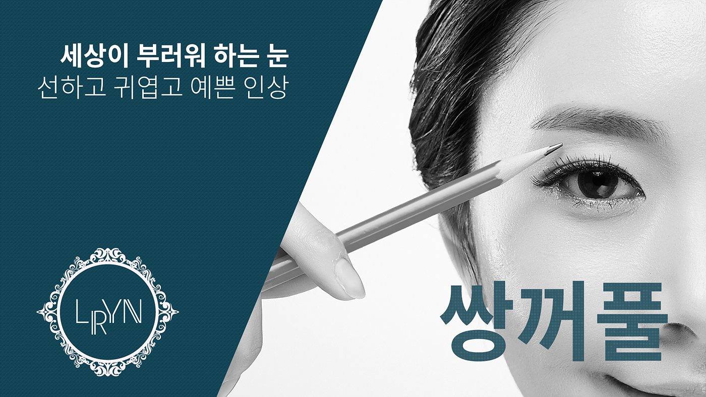 엘린의원, 쌍꺼풀 - 선하고 귀엽고 예쁜 인상