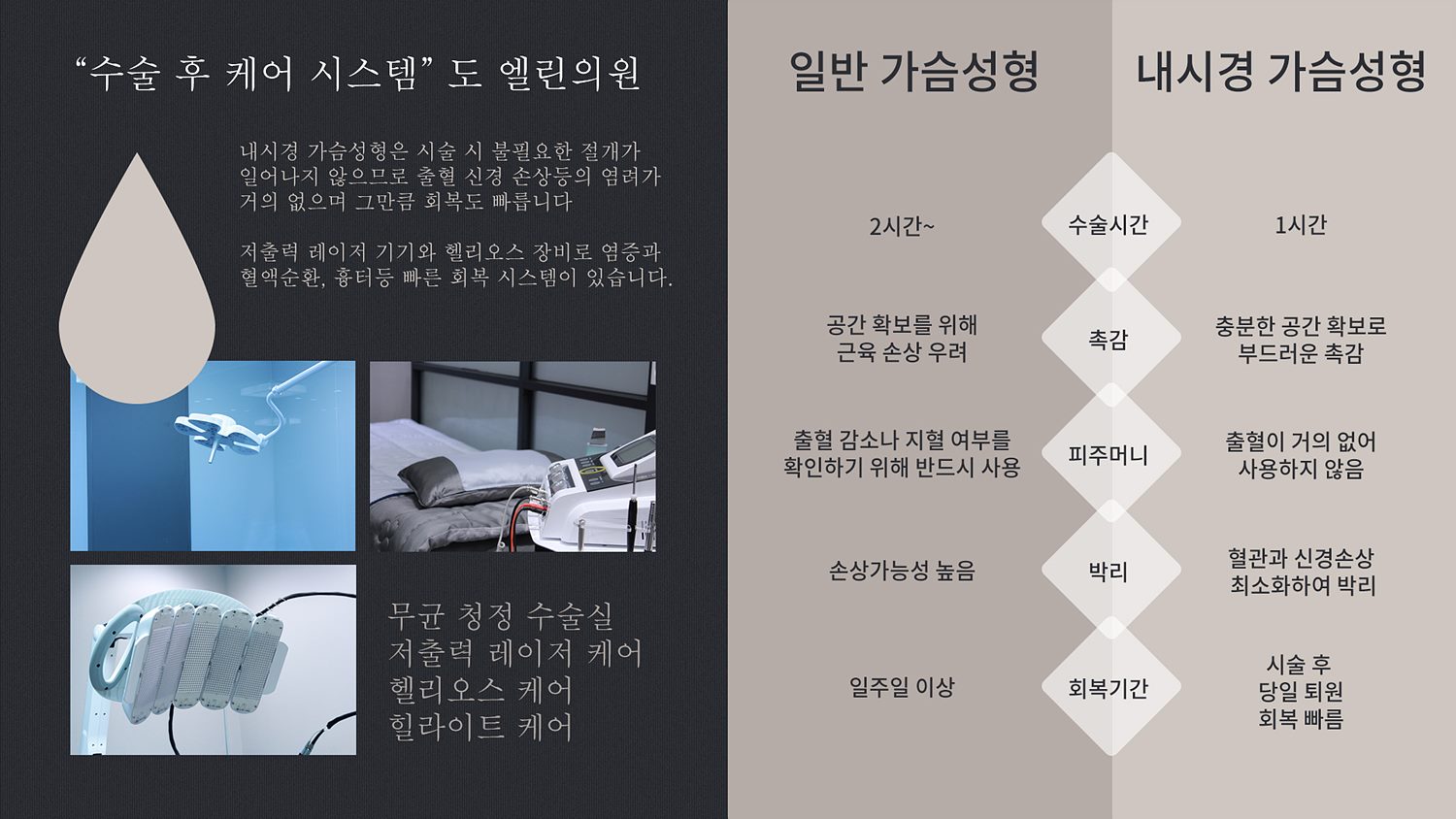 내시경 물방울 가슴성형