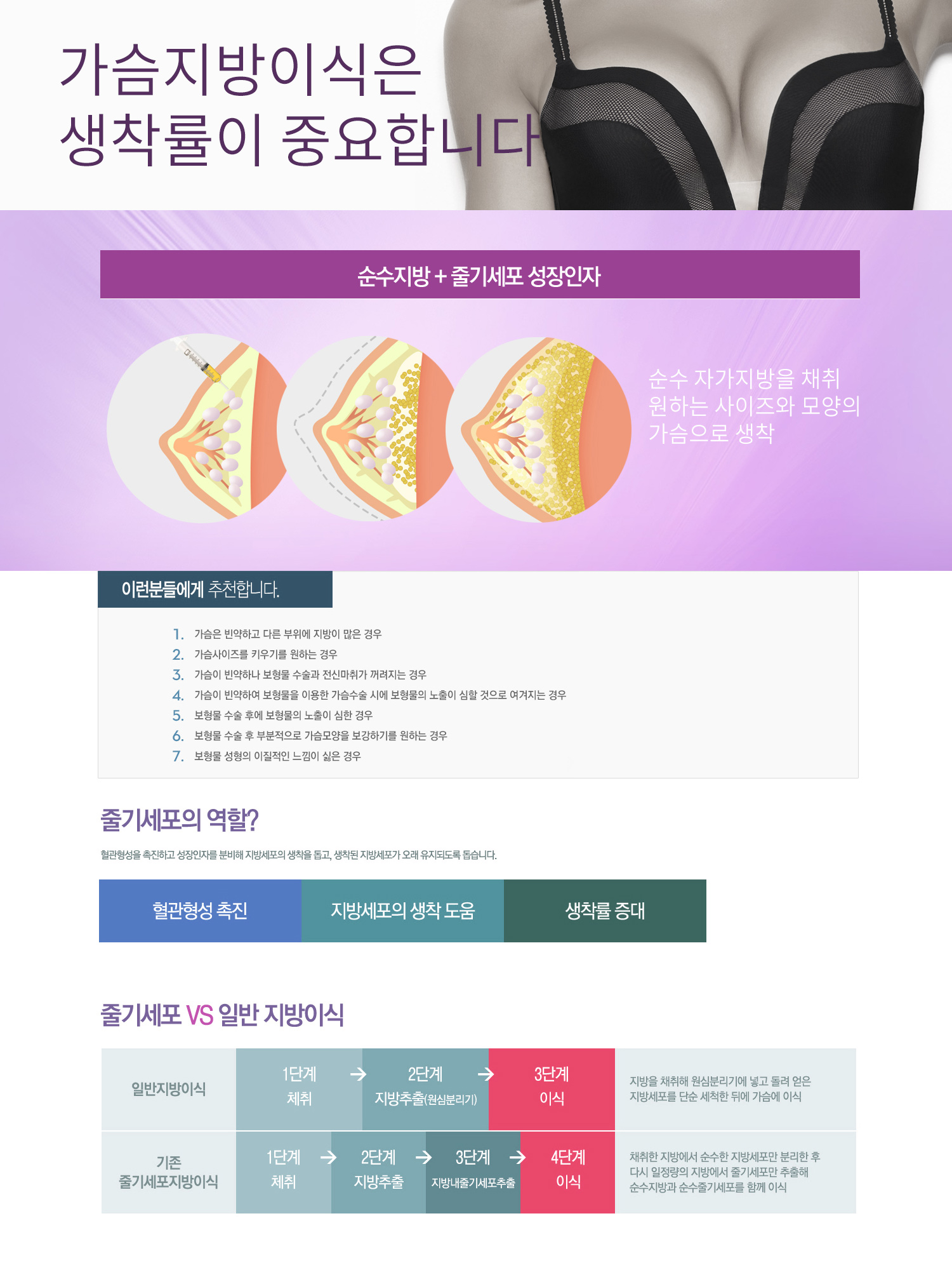 줄기세포 가슴성형