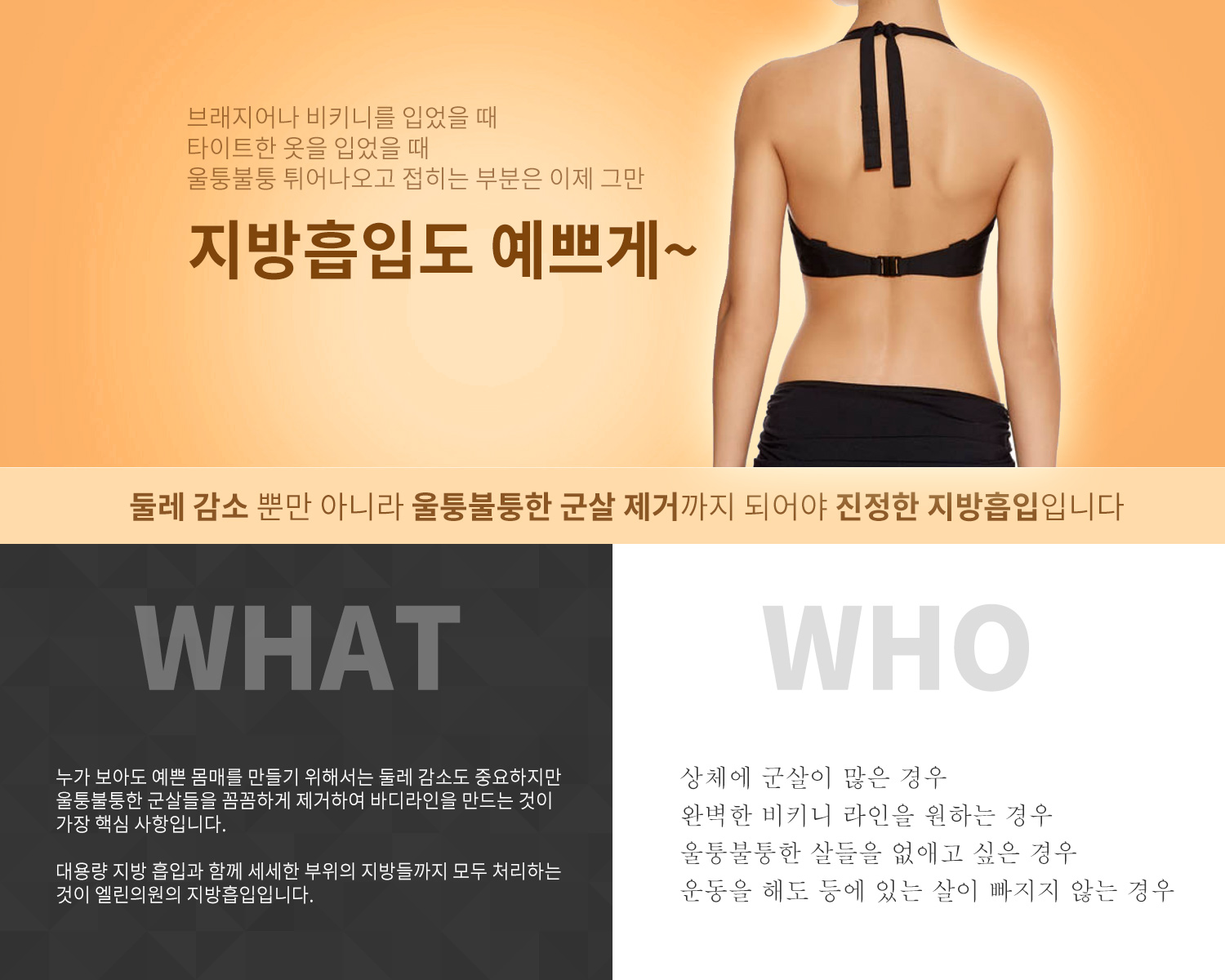 트리플 지방흡입