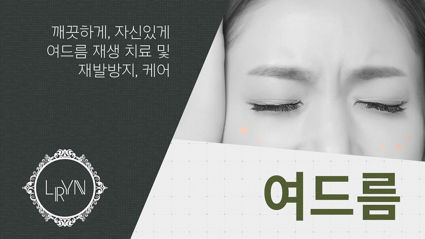 엘린의원, 여드름 - 깨끗하게, 자신있게 여드름 재생 치료 및 재발방지, 케어