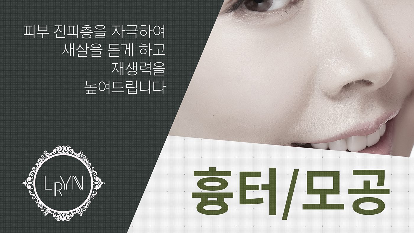 엘린의원, 흉터/모공 - 피부 진피층을 자극하여 새살을 돋게 하고 재생력을 높여주는